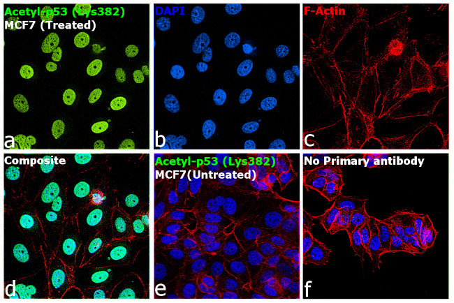 Acetyl-p53 (Lys382) Antibody in Immunocytochemistry (ICC/IF)