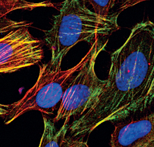 Phospho-MYL9 (Ser19) Antibody in Immunocytochemistry (ICC/IF)
