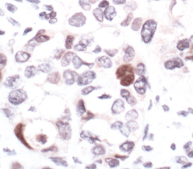 Phospho-CHK2 (Ser19) Antibody in Immunohistochemistry (Paraffin) (IHC (P))