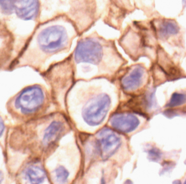 Phospho-SRC (Tyr530) Antibody in Immunohistochemistry (Paraffin) (IHC (P))
