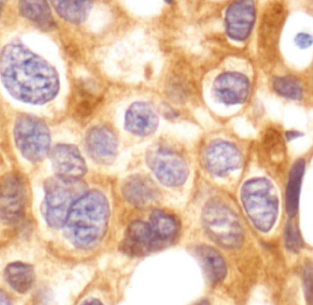 IKK gamma Antibody in Immunohistochemistry (IHC)