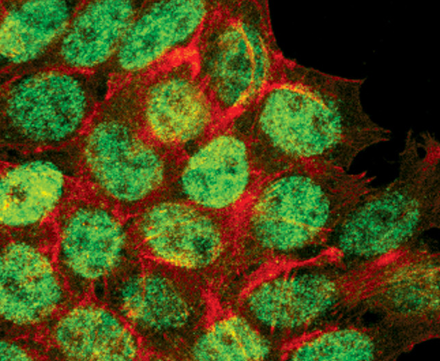 Phospho-p53 (Ser46) Antibody in Immunocytochemistry (ICC/IF)