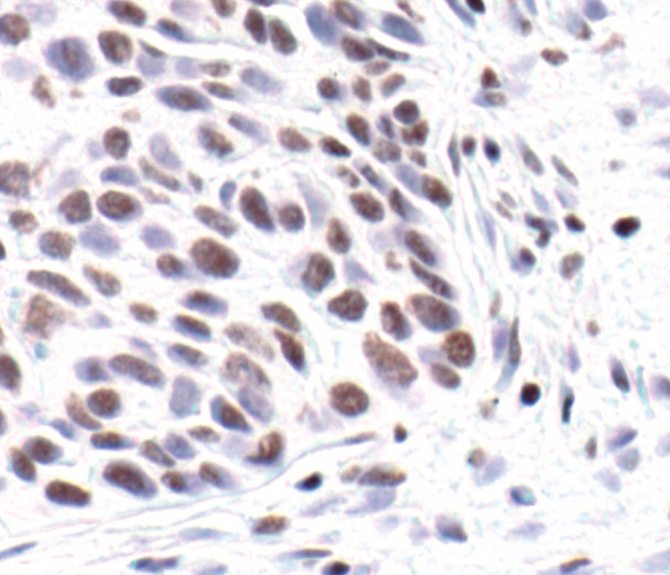 H3K9ac Antibody in Immunohistochemistry (IHC)