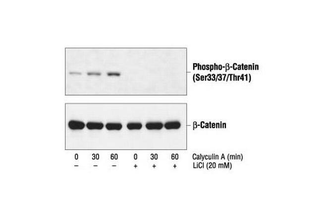 Phospho-beta Catenin (Ser33, Ser37, Thr41) Antibody in Western Blot (WB)