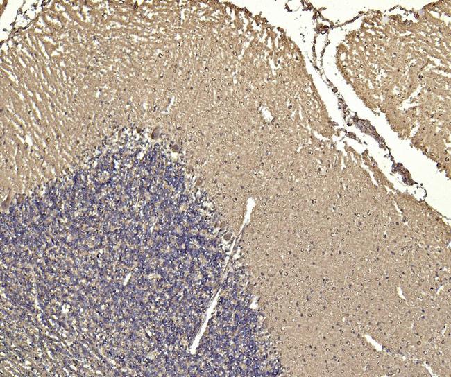 SORL1 Antibody in Immunohistochemistry (Paraffin) (IHC (P))