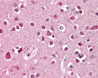XAB2 Antibody in Immunohistochemistry (Paraffin) (IHC (P))