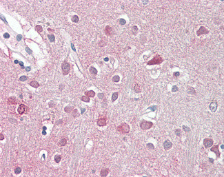 ORC3 Antibody in Immunohistochemistry (Paraffin) (IHC (P))