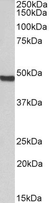 ORC4 Antibody in Western Blot (WB)