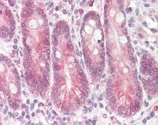 STAP2 Antibody in Immunohistochemistry (Paraffin) (IHC (P))