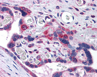 TMX Antibody in Immunohistochemistry (Paraffin) (IHC (P))