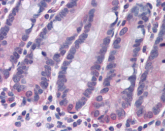STAP2 Antibody in Immunohistochemistry (Paraffin) (IHC (P))