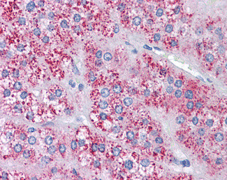 MTA1 Antibody in Immunohistochemistry (Paraffin) (IHC (P))