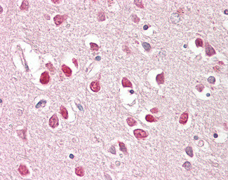 BAIAP2 Antibody in Immunohistochemistry (Paraffin) (IHC (P))