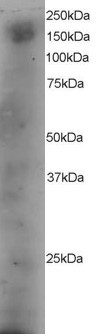DOCK1 Antibody in Western Blot (WB)