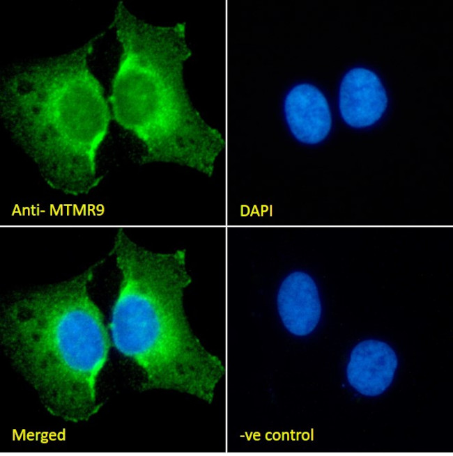 Mtmr9 Antibody in Immunocytochemistry (ICC/IF)