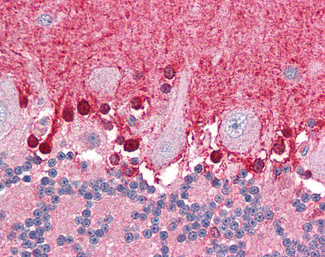 BPOZ Antibody in Immunohistochemistry (Paraffin) (IHC (P))