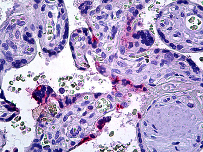 DOK3 Antibody in Immunohistochemistry (Paraffin) (IHC (P))