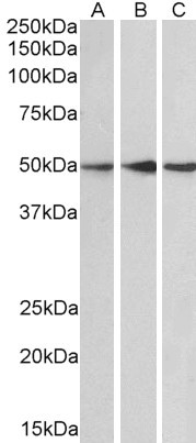 PPP2R5E Antibody in Western Blot (WB)