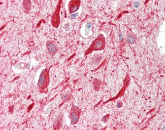 PPP2R5A Antibody in Immunohistochemistry (Paraffin) (IHC (P))
