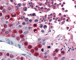 ATF7 Antibody in Immunohistochemistry (Paraffin) (IHC (P))