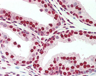 PLRG1 Antibody in Immunohistochemistry (Paraffin) (IHC (P))