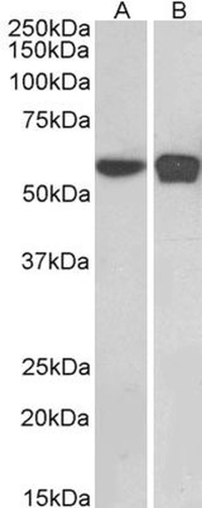 PLRG1 Antibody in Western Blot (WB)