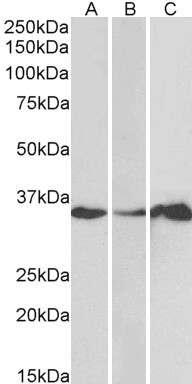 LASP1 Antibody in Western Blot (WB)