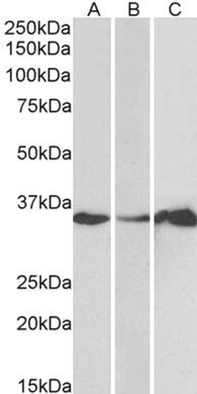 LASP1 Antibody in Western Blot (WB)