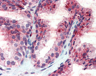 CDCP1 Antibody in Immunohistochemistry (Paraffin) (IHC (P))