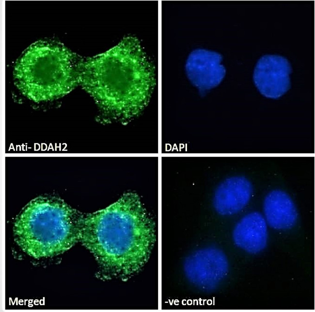 DDAH2 Antibody in Immunocytochemistry (ICC/IF)