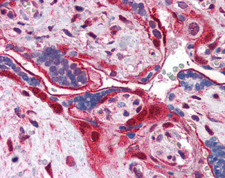 Annexin A11 Antibody in Immunohistochemistry (Paraffin) (IHC (P))