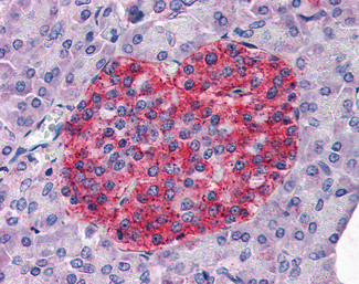 Annexin A10 Antibody in Immunohistochemistry (Paraffin) (IHC (P))