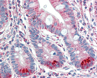 Spinesin Antibody in Immunohistochemistry (Paraffin) (IHC (P))