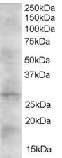 DKK2 Antibody in Western Blot (WB)