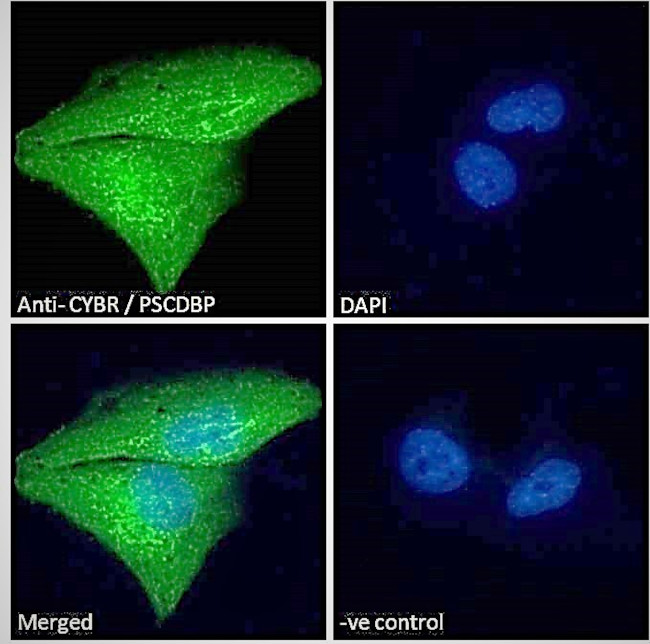 CYTIP Antibody in Immunocytochemistry (ICC/IF)