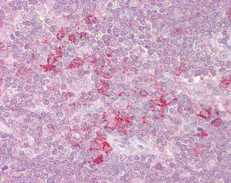 MST4 Antibody in Immunohistochemistry (Paraffin) (IHC (P))