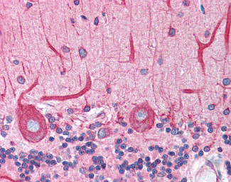 BAP31 Antibody in Immunohistochemistry (Paraffin) (IHC (P))