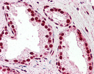 IRF6 Antibody in Immunohistochemistry (Paraffin) (IHC (P))