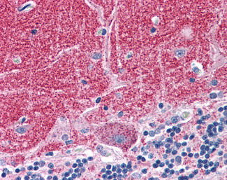 Septin 3 Antibody in Immunohistochemistry (Paraffin) (IHC (P))