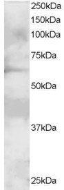 GRB7 Antibody in Western Blot (WB)