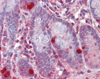 RGS1 Antibody in Immunohistochemistry (Paraffin) (IHC (P))