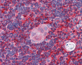 p41-ARCb Antibody in Immunohistochemistry (Paraffin) (IHC (P))