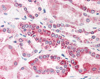 GULP1 Antibody in Immunohistochemistry (Paraffin) (IHC (P))