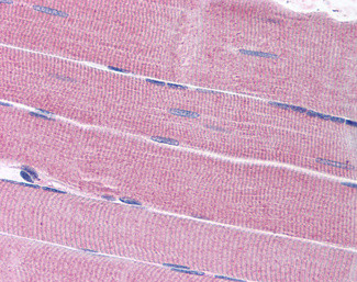 SORBS1 Antibody in Immunohistochemistry (Paraffin) (IHC (P))