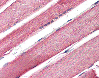 CPT1B Antibody in Immunohistochemistry (Paraffin) (IHC (P))