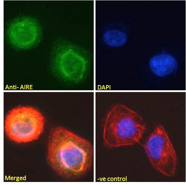 AIRE Antibody in Immunocytochemistry (ICC/IF)