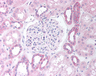 PAX8 Antibody in Immunohistochemistry (Paraffin) (IHC (P))