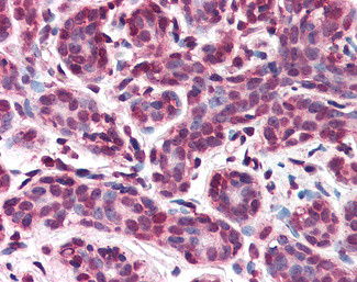 Importin 7 Antibody in Immunohistochemistry (Paraffin) (IHC (P))