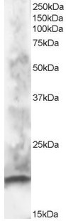CABP1 Antibody in Western Blot (WB)