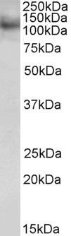 RNF31 Antibody in Western Blot (WB)